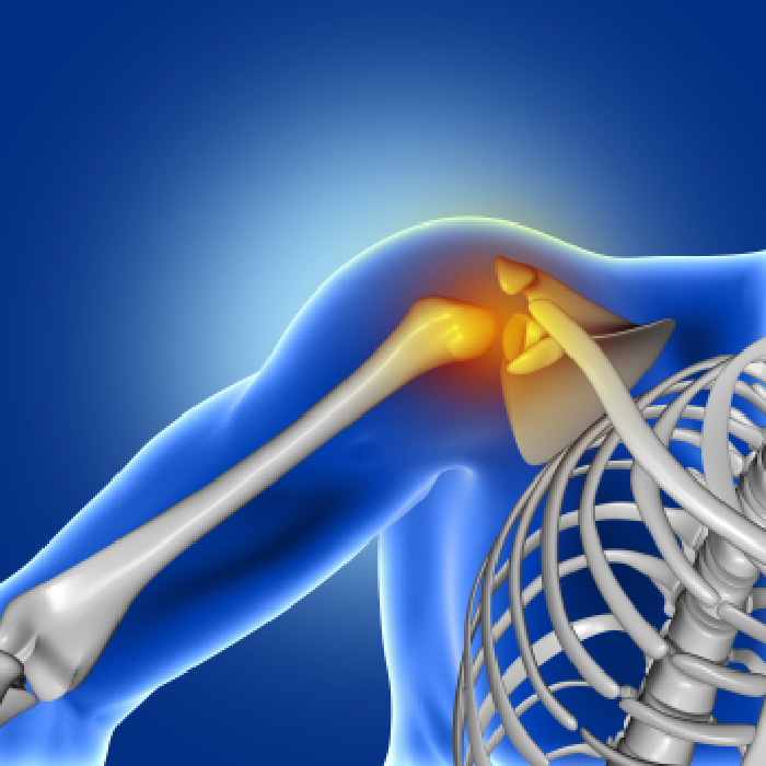 shoulder joint replacement surgery in pune